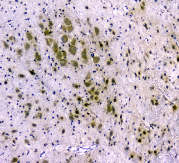 CDA / Cytidine Deaminase Antibody - IHC staining of FFPE rat brain with CDA antibody at 1ug/ml. HIER: boil tissue sections in pH6, 10mM citrate buffer, for 10-20 min and allow to cool before testing.