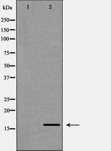CDA / Cytidine Deaminase Antibody - Western blot analysis of HeLa whole cells lysates using CDA antibody. The lane on the left is treated with the antigen-specific peptide.