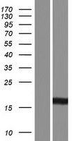 CDA / Cytidine Deaminase Protein - Western validation with an anti-DDK antibody * L: Control HEK293 lysate R: Over-expression lysate