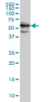 CDADC1 Antibody - CDADC1 monoclonal antibody (M01), clone 1A2. Western blot of CDADC1 expression in Raw 264.7.