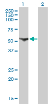CDADC1 Antibody - Western blot of CDADC1 expression in transfected 293T cell line by CDADC1 monoclonal antibody (M01), clone 1A2.