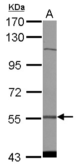 CDADC1 Antibody - Sample (30 ug of whole cell lysate) A: NT2D1 7.5% SDS PAGE CDADC1 antibody diluted at 1:1000