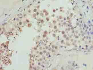 CDADC1 Antibody - Immunohistochemistry of paraffin-embedded human testis tissue using antibody at dilution of 1:100.