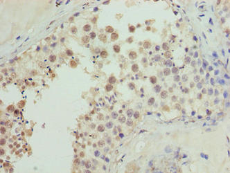 CDADC1 Antibody - Immunohistochemistry of paraffin-embedded human testis tissue using CDADC1 Antibody at dilution of 1:100