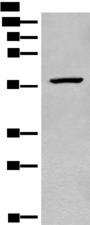CDADC1 Antibody - Western blot analysis of Mouse heart tissue lysate  using CDADC1 Polyclonal Antibody at dilution of 1:450