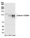 CDAN1 Antibody - Detection of human Codanin 1/CDAN1 by western blot. Samples: Whole cell lysate (50 µg) from HeLa, HEK293T, and Jurkat cells prepared using NETN lysis buffer. Antibody: Affinity purified rabbit anti-Codanin 1/CDAN1 antibody used for WB at 0.4 µg/ml. Detection: Chemiluminescence with an exposure time of 30 seconds.