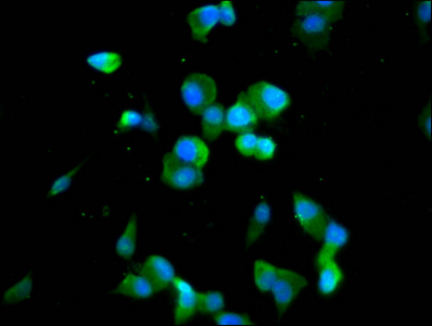 CDAN1 Antibody - Immunofluorescence staining of SH-SY5Y cells diluted at 1:100, counter-stained with DAPI. The cells were fixed in 4% formaldehyde, permeabilized using 0.2% Triton X-100 and blocked in 10% normal Goat Serum. The cells were then incubated with the antibody overnight at 4°C.The Secondary antibody was Alexa Fluor 488-congugated AffiniPure Goat Anti-Rabbit IgG (H+L).