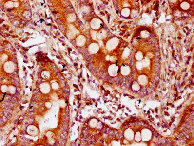 CDAN1 Antibody - Immunohistochemistry Dilution at 1:300 and staining in paraffin-embedded human small intestine tissue performed on a Leica BondTM system. After dewaxing and hydration, antigen retrieval was mediated by high pressure in a citrate buffer (pH 6.0). Section was blocked with 10% normal Goat serum 30min at RT. Then primary antibody (1% BSA) was incubated at 4°C overnight. The primary is detected by a biotinylated Secondary antibody and visualized using an HRP conjugated SP system.