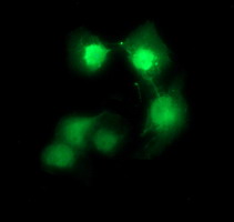 CDC123 Antibody - Anti-CDC123 mouse monoclonal antibody immunofluorescent staining of COS7 cells transiently transfected by pCMV6-ENTRY CDC123.