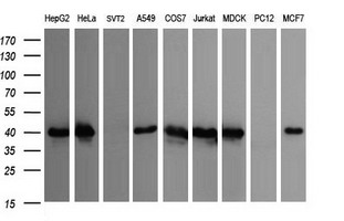 CDC123 Antibody - Western blot of extracts (35 ug) from 9 different cell lines by using anti-CDC123 monoclonal antibody (HepG2: human; HeLa: human; SVT2: mouse; A549: human; COS7: monkey; Jurkat: human; MDCK: canine; PC12: rat; MCF7: human).