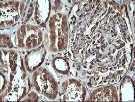 CDC123 Antibody - IHC of paraffin-embedded Human Kidney tissue using anti-CDC123 mouse monoclonal antibody.