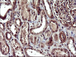 CDC123 Antibody - IHC of paraffin-embedded Human Kidney tissue using anti-CDC123 mouse monoclonal antibody. (Heat-induced epitope retrieval by 10mM citric buffer, pH6.0, 120°C for 3min).