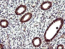CDC123 Antibody - IHC of paraffin-embedded Human endometrium tissue using anti-CDC123 mouse monoclonal antibody. (Heat-induced epitope retrieval by 10mM citric buffer, pH6.0, 120°C for 3min).