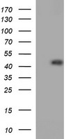 CDC123 Antibody - HEK293T cells were transfected with the pCMV6-ENTRY control (Left lane) or pCMV6-ENTRY CDC123 (Right lane) cDNA for 48 hrs and lysed. Equivalent amounts of cell lysates (5 ug per lane) were separated by SDS-PAGE and immunoblotted with anti-CDC123.