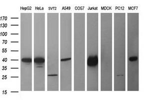 CDC123 Antibody - Western blot of extracts (35ug) from 9 different cell lines by using anti-CDC123 monoclonal antibody (HepG2: human; HeLa: human; SVT2: mouse; A549: human; COS7: monkey; Jurkat: human; MDCK: canine; PC12: rat; MCF7: human).