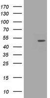 CDC123 Antibody - HEK293T cells were transfected with the pCMV6-ENTRY control (Left lane) or pCMV6-ENTRY CDC123 (Right lane) cDNA for 48 hrs and lysed. Equivalent amounts of cell lysates (5 ug per lane) were separated by SDS-PAGE and immunoblotted with anti-CDC123.