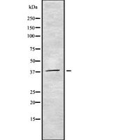 CDC123 Antibody - Western blot analysis of CDC123 using COLO205 whole cells lysates