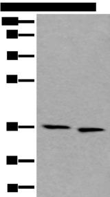 CDC123 Antibody - Western blot analysis of 293T and Hela cell lysates  using CDC123 Polyclonal Antibody at dilution of 1:550