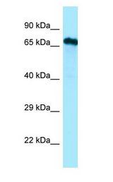 Cdc14 / CDC14A Antibody - Cdc14 / CDC14A antibody Western Blot of RPMI-8226.  This image was taken for the unconjugated form of this product. Other forms have not been tested.