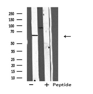 Cdc14 / CDC14A Antibody - Western blot analysis of extracts of HeLa cells using CC14A antibody.