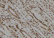 CDC14B Antibody - 1:100 staining human kidney tissue by IHC-P. The sample was formaldehyde fixed and a heat mediated antigen retrieval step in citrate buffer was performed. The sample was then blocked and incubated with the antibody for 1.5 hours at 22°C. An HRP conjugated goat anti-rabbit antibody was used as the secondary.