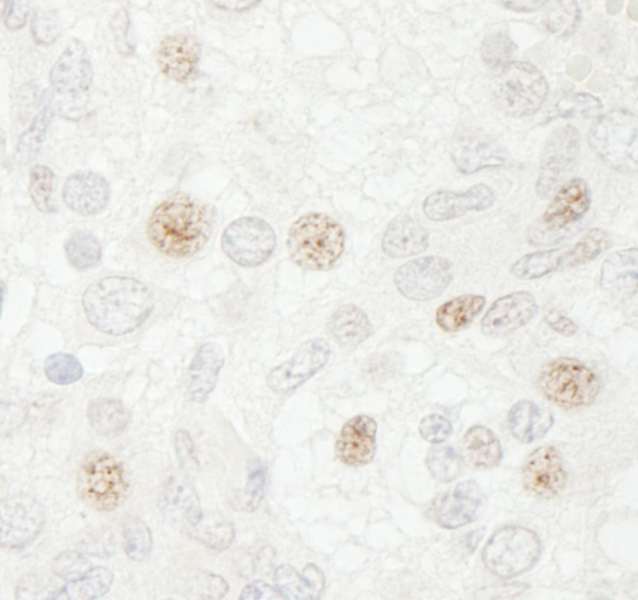 CDC20 Antibody - Detection of Mouse CDC20 by Immunohistochemistry. Sample: FFPE section of mouse teratoma. Antibody: Affinity purified rabbit anti-CDC20 used at a dilution of 1:250.