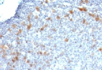 CDC20 Antibody - Formalin-fixed, paraffin-embedded human tonsil stained with Cdc20 antibody (CDC20/1102).  This image was taken for the unmodified form of this product. Other forms have not been tested.