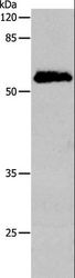 CDC20 Antibody - Western blot analysis of Human cervical cancer tissue, using CDC20 Polyclonal Antibody at dilution of 1:600.