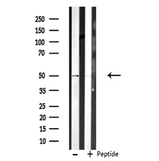 CDC20 Antibody - Western blot analysis of extracts of HeLa cells using CDC20 antibody.
