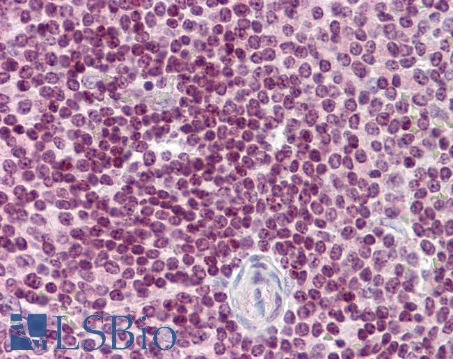 CDC20 Antibody - Anti-CDC20 antibody IHC of human spleen. Immunohistochemistry of formalin-fixed, paraffin-embedded tissue after heat-induced antigen retrieval. Antibody concentration 5 ug/ml.  This image was taken for the unconjugated form of this product. Other forms have not been tested.