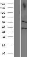 CDC20B Protein - Western validation with an anti-DDK antibody * L: Control HEK293 lysate R: Over-expression lysate