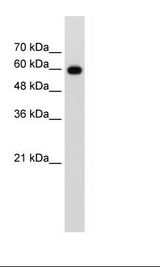 CDC23 Antibody - Jurkat Cell Lysate.  This image was taken for the unconjugated form of this product. Other forms have not been tested.