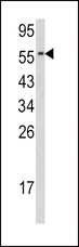 CDC23 Antibody - Western blot of CDC23 antibody in HL60 cell line lysates(35 ug/lane). CDC23 (arrow) was detected using the purified antibody.
