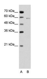 CDC23 Antibody - A: Marker, B: Jurkat Cell Lysate.  This image was taken for the unconjugated form of this product. Other forms have not been tested.