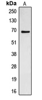 CDC23 Antibody - Western blot analysis of CDC23 expression in Jurkat (A) whole cell lysates.