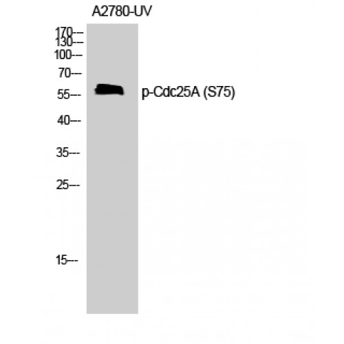 CDC25A Antibody - Western blot of Phospho-Cdc25A (S75) antibody