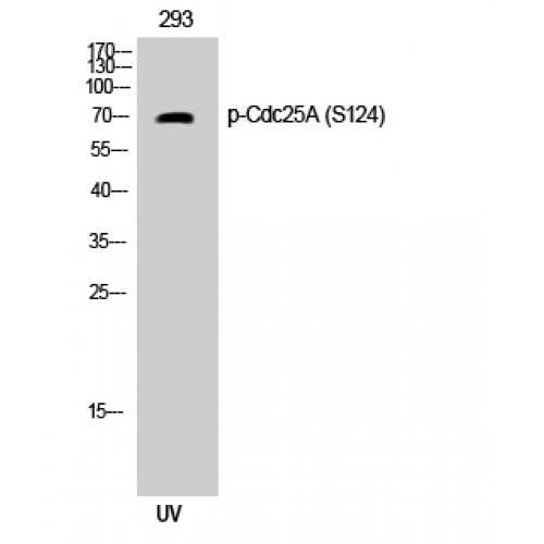 CDC25A Antibody - Western blot of Phospho-Cdc25A (S124) antibody