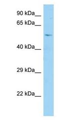 CDC25A Antibody - CDC25A antibody Western Blot of Fetal Brain.  This image was taken for the unconjugated form of this product. Other forms have not been tested.