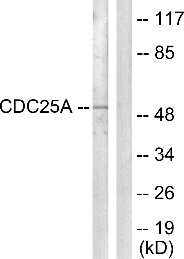 CDC25A Antibody - Western blot analysis of lysates from HepG2 cells, using CDC25A Antibody. The lane on the right is blocked with the synthesized peptide.