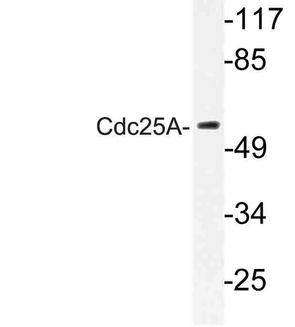 CDC25A Antibody - Western blot of Cdc25A (N70) pAb in extracts from Jurkat cells.