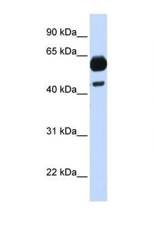 CDC25A Antibody - CDC25A antibody Western blot of Fetal Brain lysate. Antibody concentration 1 ug/ml. This image was taken for the unconjugated form of this product. Other forms have not been tested.