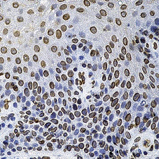 CDC25A Antibody - Formalin-fixed, paraffin-embedded human tonsil stained with Cdc25A antibody.