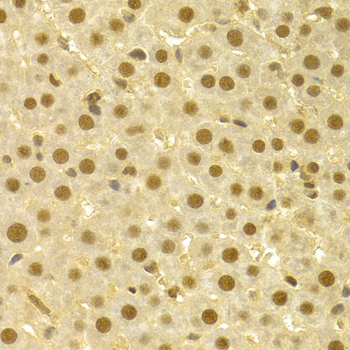 CDC25A Antibody - Immunohistochemistry of formalin-fixed paraffin-embedded (FFPE) rat liver using CDC25A antibody at dilution of 1:100 (40x magnification).
