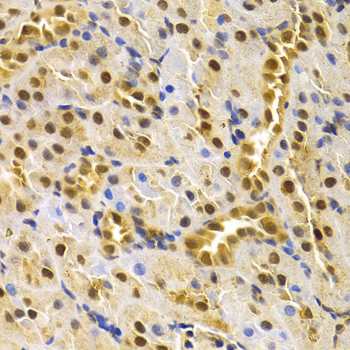 CDC25A Antibody - Immunohistochemistry of paraffin-embedded rat kidney using CDC25A antibodyat dilution of 1:100 (40x lens).