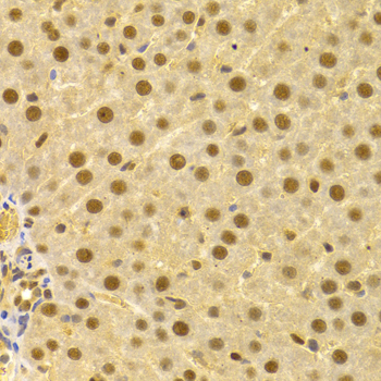 CDC25A Antibody - Immunohistochemistry of paraffin-embedded human liver injury using CDC25A antibodyat dilution of 1:100 (40x lens).