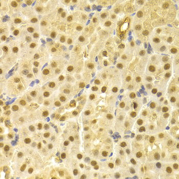 CDC25A Antibody - Immunohistochemistry of paraffin-embedded mouse kidney using CDC25A antibodyat dilution of 1:100 (40x lens).