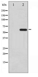 CDC25A Antibody - Western blot of CDC25A expression in UV treated A2780 whole cell lysates,The lane on the left is treated with the antigen-specific peptide.