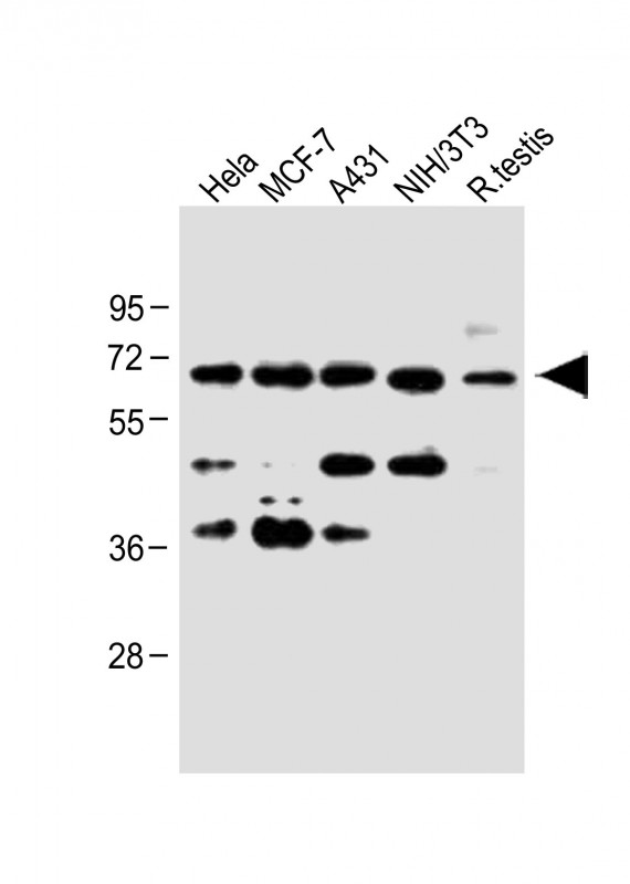 CDC25A Antibody - All lanes: Anti-CDC25A (S124) at 1:1000 dilution Lane 1: Hela whole cell lysate Lane 2: MCF-7 whole cell lysate Lane 3: A431 whole cell lysate Lane 4: NIH/3T3 whole cell lysate Lane 5: Rat testis lysate Lysates/proteins at 20 µg per lane. Secondary Goat Anti-Rabbit IgG, (H+L), Peroxidase conjugated at 1/10000 dilution. Predicted band size: 59 kDa Blocking/Dilution buffer: 5% NFDM/TBST.