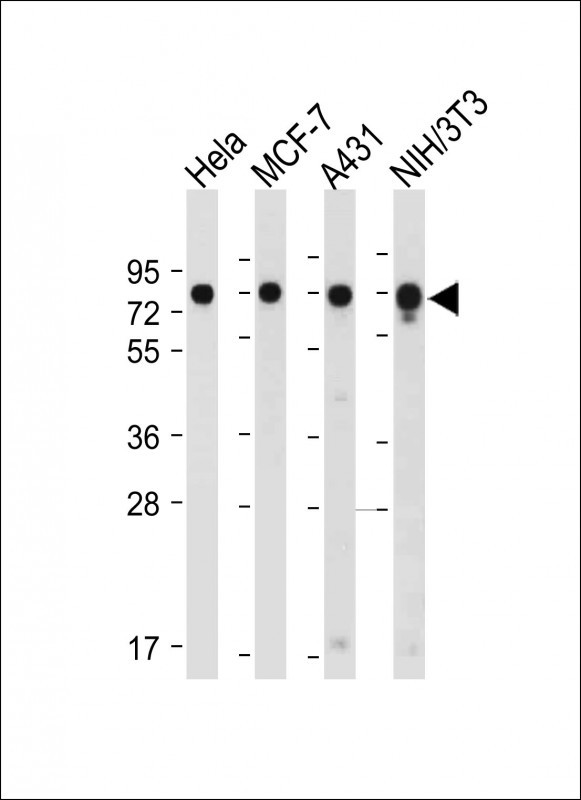 CDC25A Antibody - All lanes: Anti-CDC25A (S124) at 1:2000 dilution Lane 1: Hela whole cell lysate Lane 2: MCF-7 whole cell lysate Lane 3: A431 whole cell lysate Lane 4: NIH/3T3 whole cell lysate Lysates/proteins at 20 µg per lane. Secondary Goat Anti-Rabbit IgG, (H+L), Peroxidase conjugated at 1/10000 dilution. Predicted band size: 59 kDa Blocking/Dilution buffer: 5% NFDM/TBST.