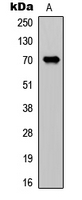 CDC25A Antibody - Western blot analysis of CDC25A expression in MCF7 (A) whole cell lysates.